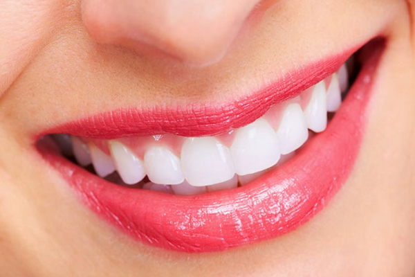 Diamond xóa tan giới hạn giữa răng thật và răng giả, được các chuyên gia đánh giá cao về khả năng phục hình răng